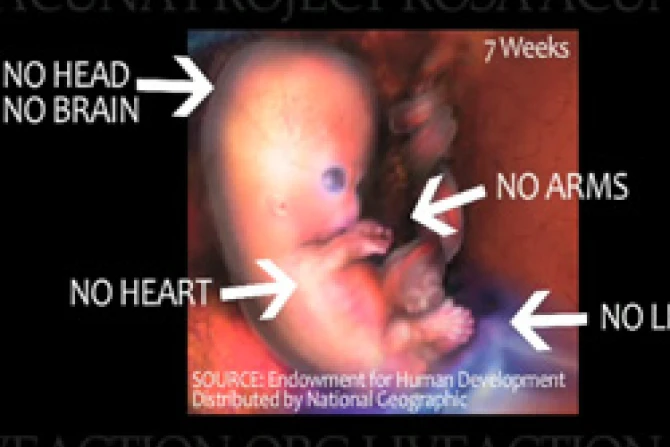 04 12 2010 RosaAcunaProject