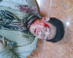 Br. Anthony Nguyen Van Tang after being beaten by police.?w=200&h=150