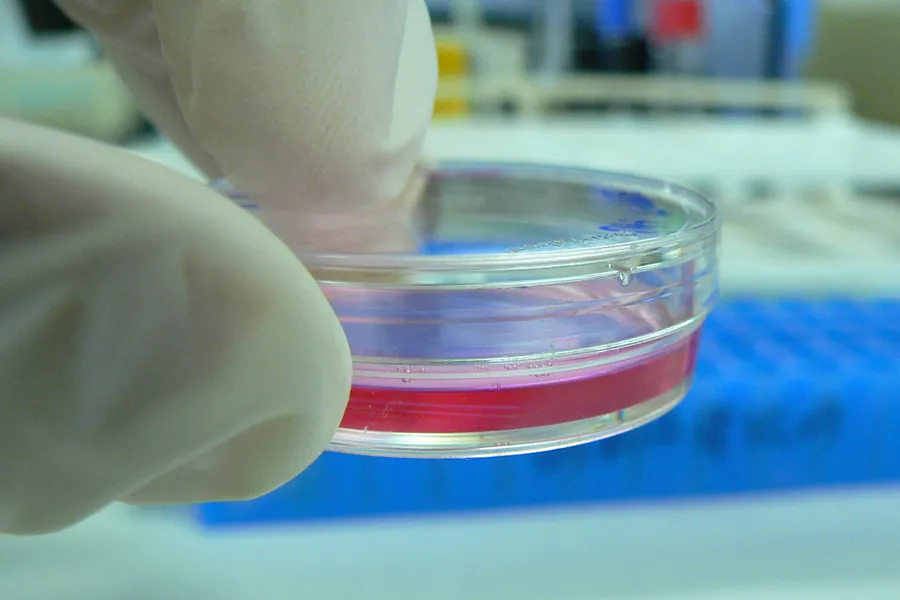 A scientist holds a petri dish. File Photo. ?w=200&h=150