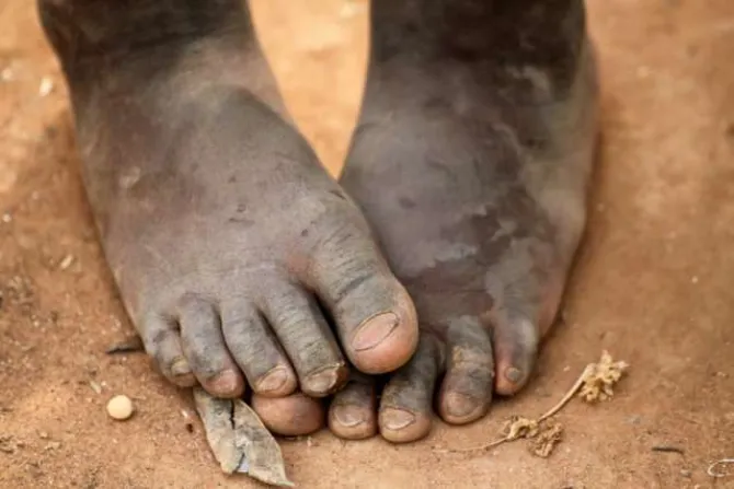 African child feet Photo credit Goran Bogicevic via Shutterstock CNA
