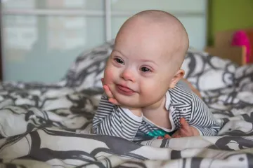 Baby with Down syndrome Credit Tatiana Dyuvbanova Shutterstock CNA