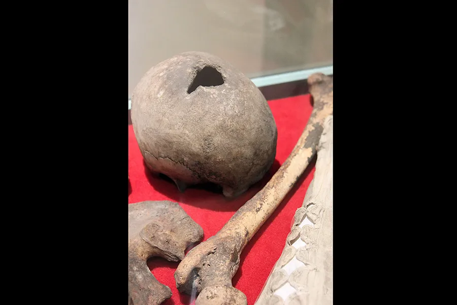 The bones which are believed to belong to English martyr and priest St. John Plessington. Photo courtesy of the Diocese of Shrewsbury/Simon Caldwell.?w=200&h=150