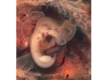 A human embryo in the seventh week of ectopic pregnancy in a Fallopian tube. 