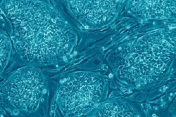 Embryonic Stem Cells Credit Nissim Benvenisty CC by 25 CNA US Catholic News 5 16 13