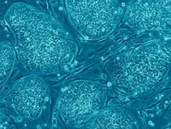 Embryonic Stem Cells. ?w=200&h=150