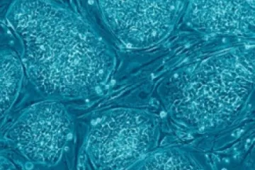 Embryonic Stem Cells Credit Nissim Benvenisty CC by 25 EWTN US Catholic News 5 16 13