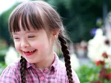 A girl with Down syndrome. 