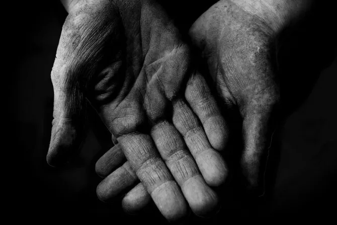 Hands after working Credit W H via Flickr Black and white added CC BY ND 20 CNA