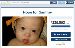 'Hope for Gammy' fundraising page.?w=200&h=150