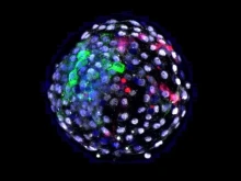 A human-monkey chimeric blastocyst. Credit: Weizhi Ji/Kunming University of Science and Technology.