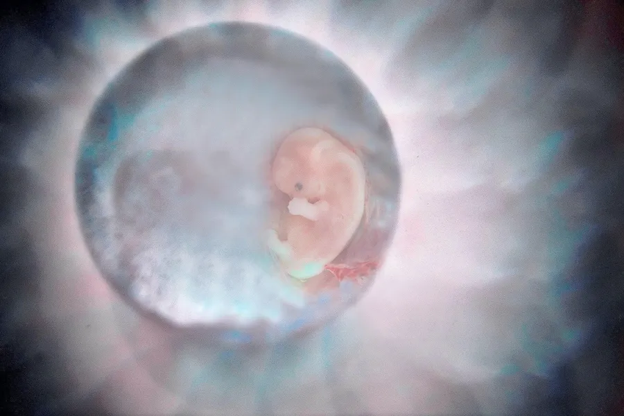 Human Embryo, File Photo. ?w=200&h=150