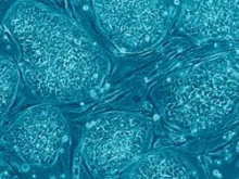 Human embryonic stem cells. 