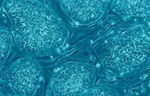 Human embryonic stem cells.   Nissim Benvenisty, Courtesy Public Library of Science (CC BY 2.5)