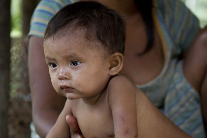 Hungry baby in Venezuela Credit DaniBlanchette via Flickr CC BY NC SA 20 CNA