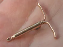 A bronze cast of an IUD. 