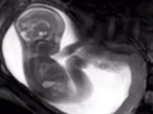 MRI scan screenshot. 