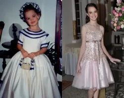 Maria Isabel Gomes de Melo one month after her recovery at age 3 (left) and today at age 15 (right).?w=200&h=150