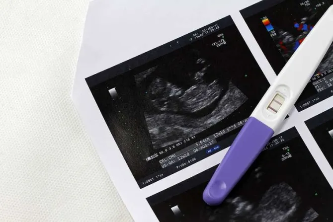 Pregnancy test ultrasound Credit Atiwich Kaewchum Shutterstock CNA