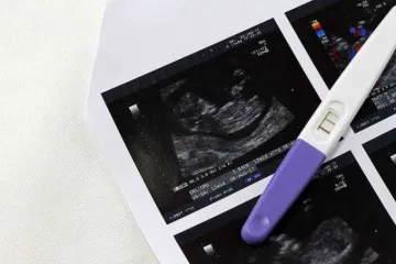 Pregnancy test ultrasound Credit Atiwich Kaewchum Shutterstock CNA 1
