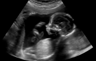 CristinaMuraca/Shutterstock.