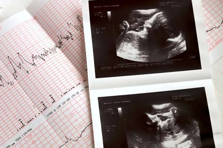 Pro-life leaders applaud Texas Supreme Court ruling upholding state’s Heartbeat Act