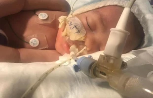 Midrar Ali. Courtesy: "Help baby Midrar Ali.