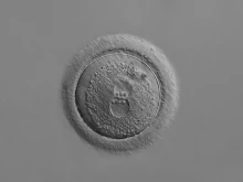 Photomicrograph of a human zygote with two pronuclei, 20x magnification.
