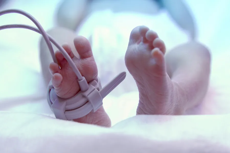 Feet of a newborn baby in an incubator. ?w=200&h=150