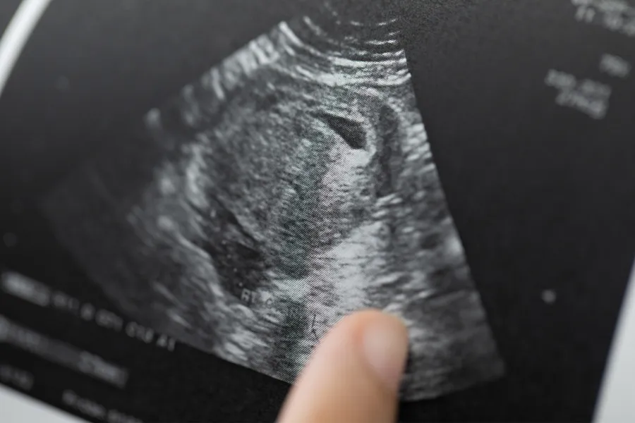 Doctor reading test results of pregnant woman by ultrasound. ?w=200&h=150