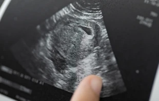 Doctor reading test results of pregnant woman by ultrasound.   Rattiya Thongdumhyu_Shutterstock
