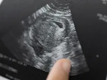 Doctor reading test results of pregnant woman by ultrasound. 