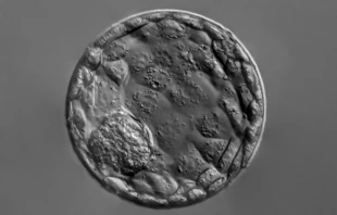 Photomicrograph of a human blastocyst, at 20x magnification. Scientists have now generated blastocyst-like structures from human cells. Credit: Vladimir Staykov/Shutterstock.