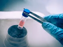A Liquid Nitrogen bank containing suspension of stem cells. 