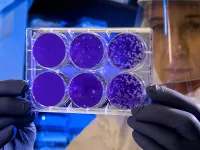 A scientist examines the result of a plaque assay, which is a test that allows scientists to count how many flu virus particles (virions) are in a mixture.