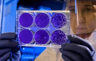 A scientist examines the result of a plaque assay, which is a test that allows scientists to count how many flu virus particles (virions) are in a mixture. CDC via Unsplash.com.