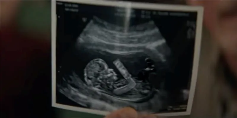 The ad, which aired during Super Bowl LVII on Feb. 12, 2023, featured a sonogram of a preborn baby.?w=200&h=150