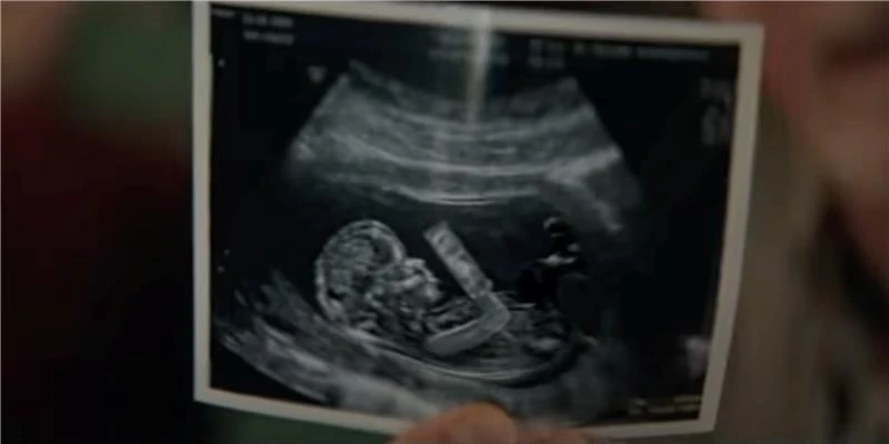 The ad, which aired during Super Bowl LVII on Feb. 12, 2023, featured a sonogram of a preborn baby.?w=200&h=150