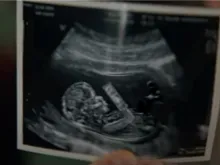 The ad, which aired during Super Bowl LVII on Feb. 12, 2023, featured a sonogram of a preborn baby.