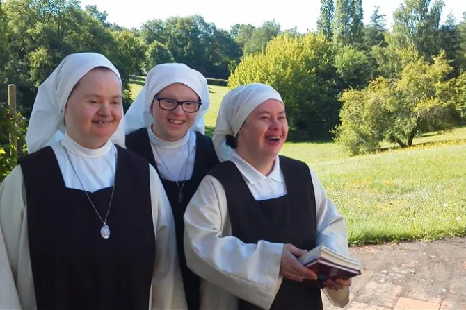 nuns down syndrome
