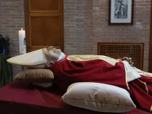 The Vatican has released photographs of the body of Pope Emeritus Benedict XVI, who died on Dec. 31, 2022, at age 95.