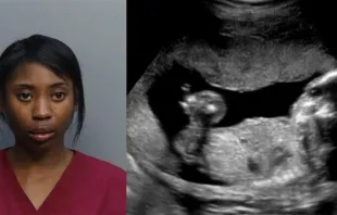 Natalia Harrell, 24, who is being held in in a Miami Dade correctional facility, is arguing that her unborn child is being unlawfully held in custody. Turner Guilford Knight Correctional Center; Ultrasound Ireland: Medical, Pregnancy Scans, & IVF Fertility Scans Nov. 24, 2014
