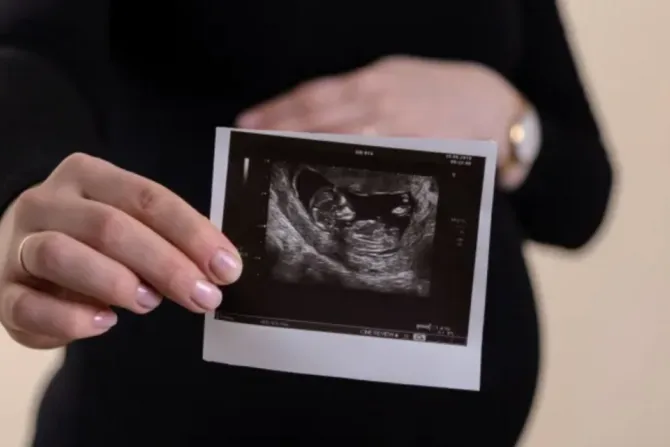 baby pregnant woman sonogram