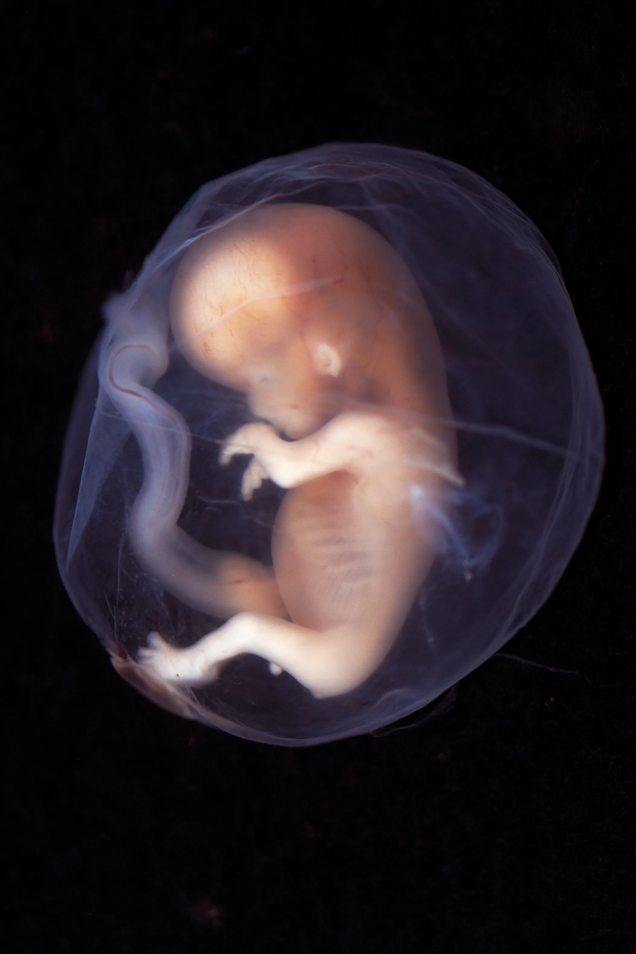 An embryo, between 9-10 weeks of pregnancy?w=200&h=150