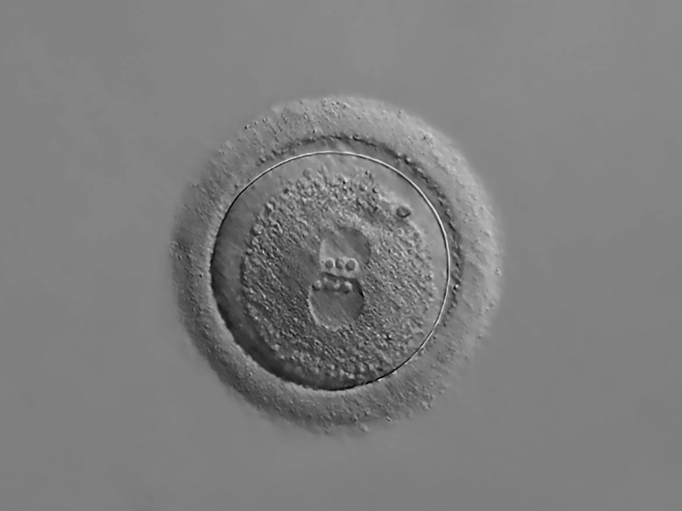 Photomicrograph of a human zygote with two pronuclei, 20x magnification.?w=200&h=150