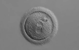 Photomicrograph of a human zygote with two pronuclei, 20x magnification. Vladimir Staykov/Shutterstock