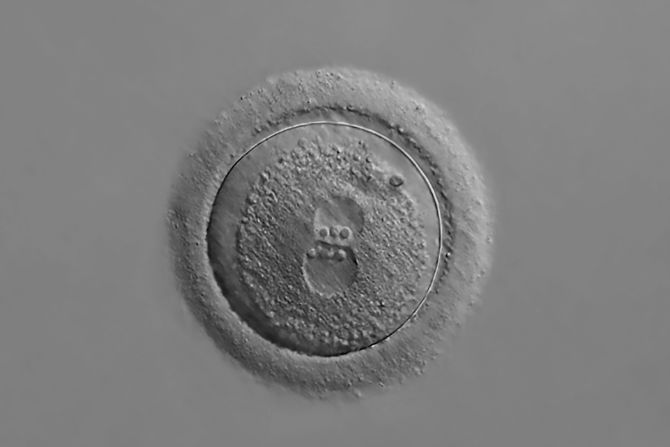 Photomicrograph of a human zygote with two pronuclei, 20x magnification.