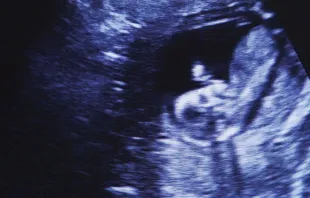 Ultrasound image. Courtesy of Matter of Life